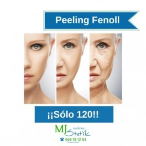 Peeling Fenol